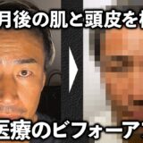 半年通った再生医療の効果は？顔&髪のビフォーアフターを検証