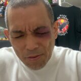目を潰されました