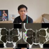 眼窩底骨折して試合欠場した詳細について