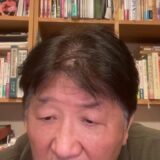 全身麻酔は要注意、退院後ヘタを打ったぜ。